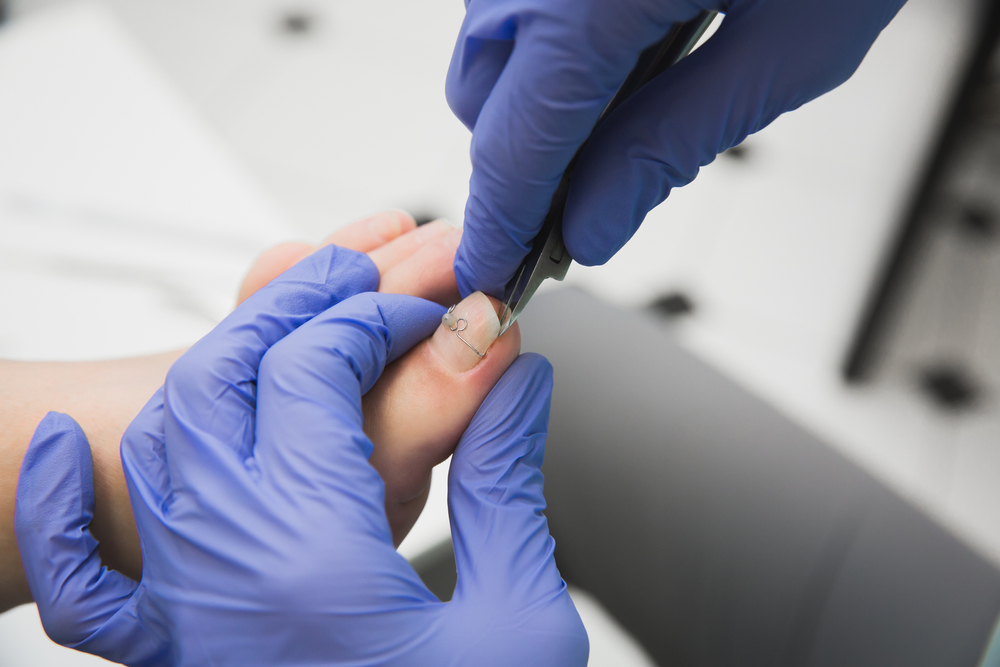 Nagelbeugel maken en plaatsen